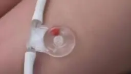 Nahaufnahme einer gefesselten Sub mit schwarzem Analplug und Urinbeutel an der Schenkelinnenseite